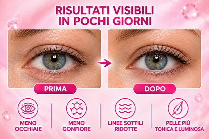 Xioimi™ - Contorno occhi collagene